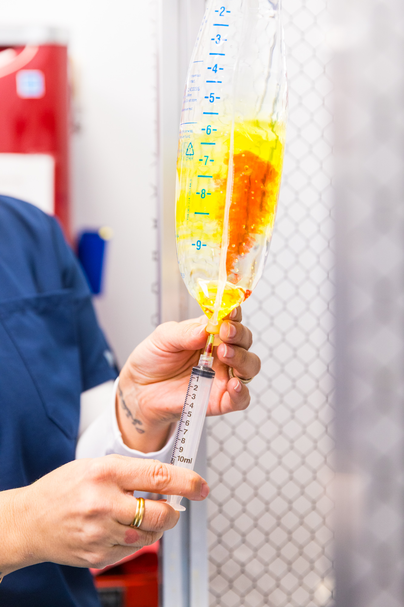 A nurse injects red-colored liquid vitamins into a clear infusion bag filled with yellow fluid.