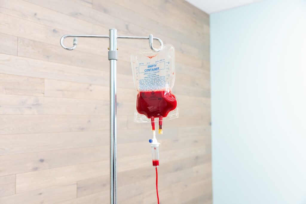 An IV bag hangs on an IV stand for ozone infusion therapy in Nashville.
